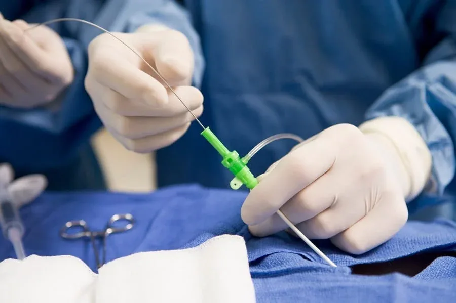 Procedimento endovascular realizado por cateter